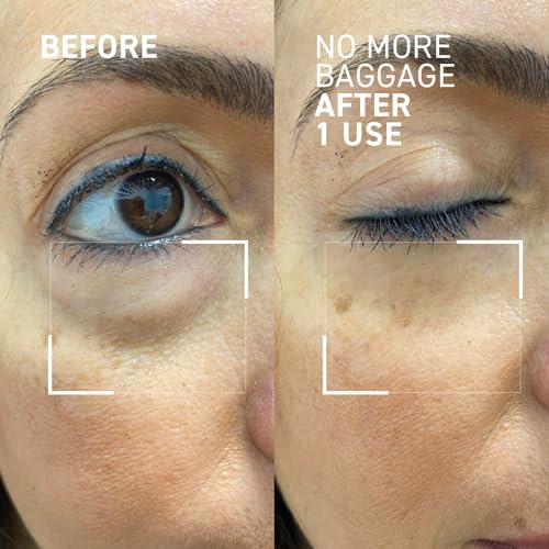 Dr. Brandt Needles No More, No More Baggage (Pack of 2, 0.23 oz Each) – Travel-Ready Instant Eye De-Puffer & Dark Circle Eraser Duo