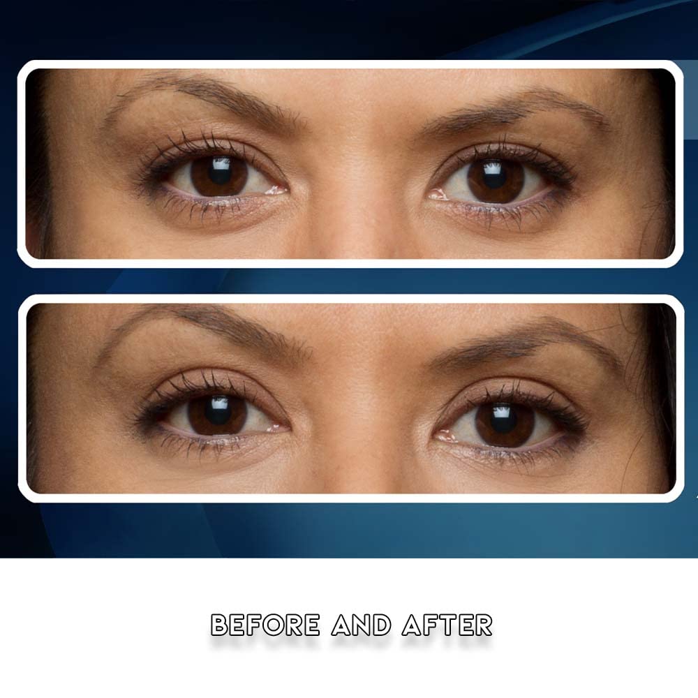 Premium Eye Lift Strips – Instant Eyelid Lift Tape for Droopy, Sagging & Hooded Eyelids, Transparent Hypoallergenic (80 Count, S/M)