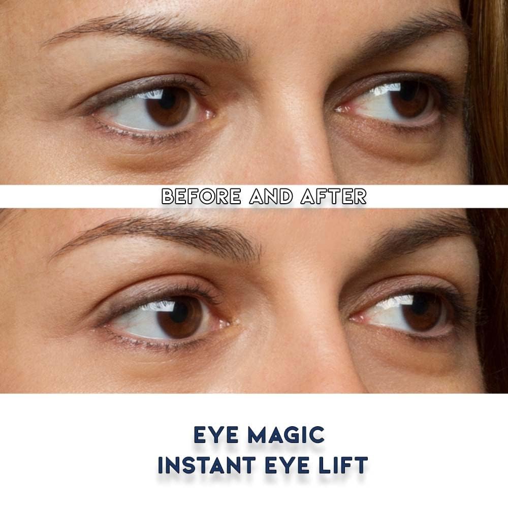 Eye Magic Premium Instant Eyelid Lift Refill (L/XL) – Invisible Eyelid Lift Strips for Droopy, Hooded Eyelids