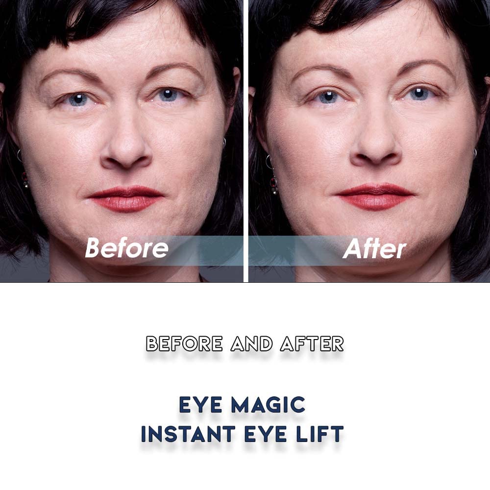 Premium Original Instant Eye Lift Kit – Eyelid Lift Strips with Wax/Gel for Droopy Upper Eyelids (64 Strips, Small/Medium)