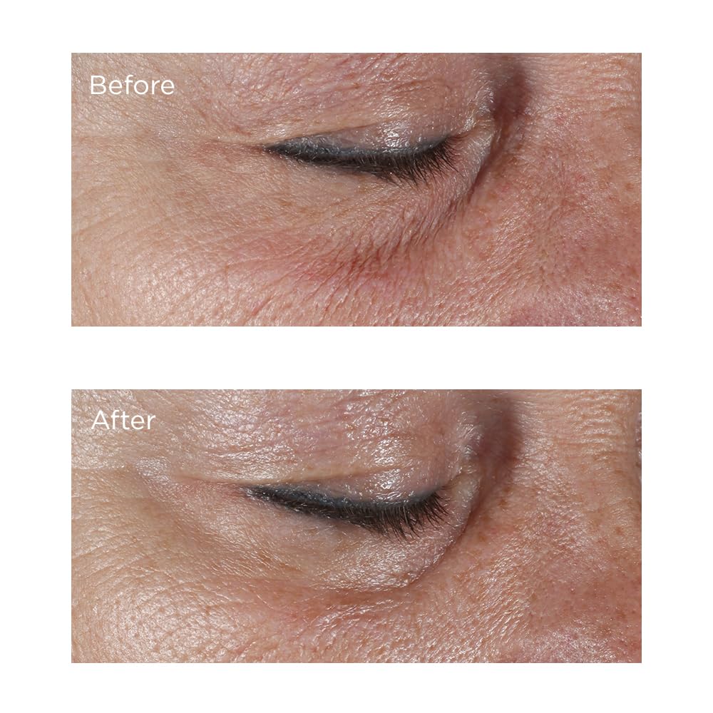 Perricone MD Hypoallergenic Firming Eye Cream (0.5 oz) - Gentle Anti-Aging for Sensitive Skin